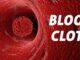 blood clots 1