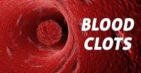 blood clots 1